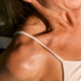 Peau bronzé